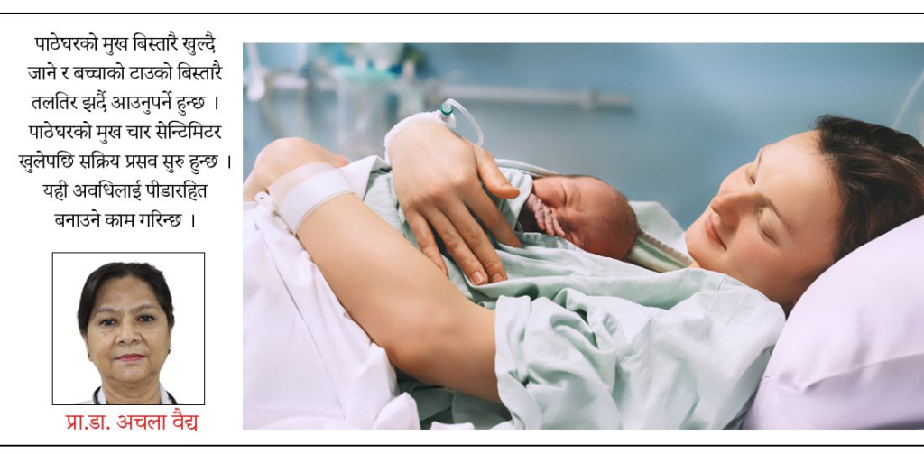 पेनलेस डेलिभरी : आमालाई पीडामा नपारी बच्चा कसरी जन्माउने ? 1 image 5